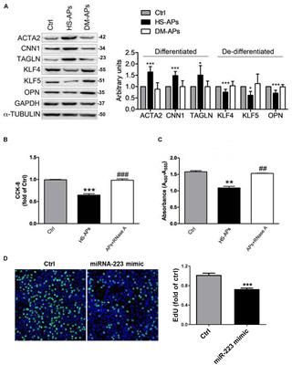 Restoring the Platelet miR-223 by Calpain Inhibition Alleviates the Neointimal Hyperplasia in Diabetes